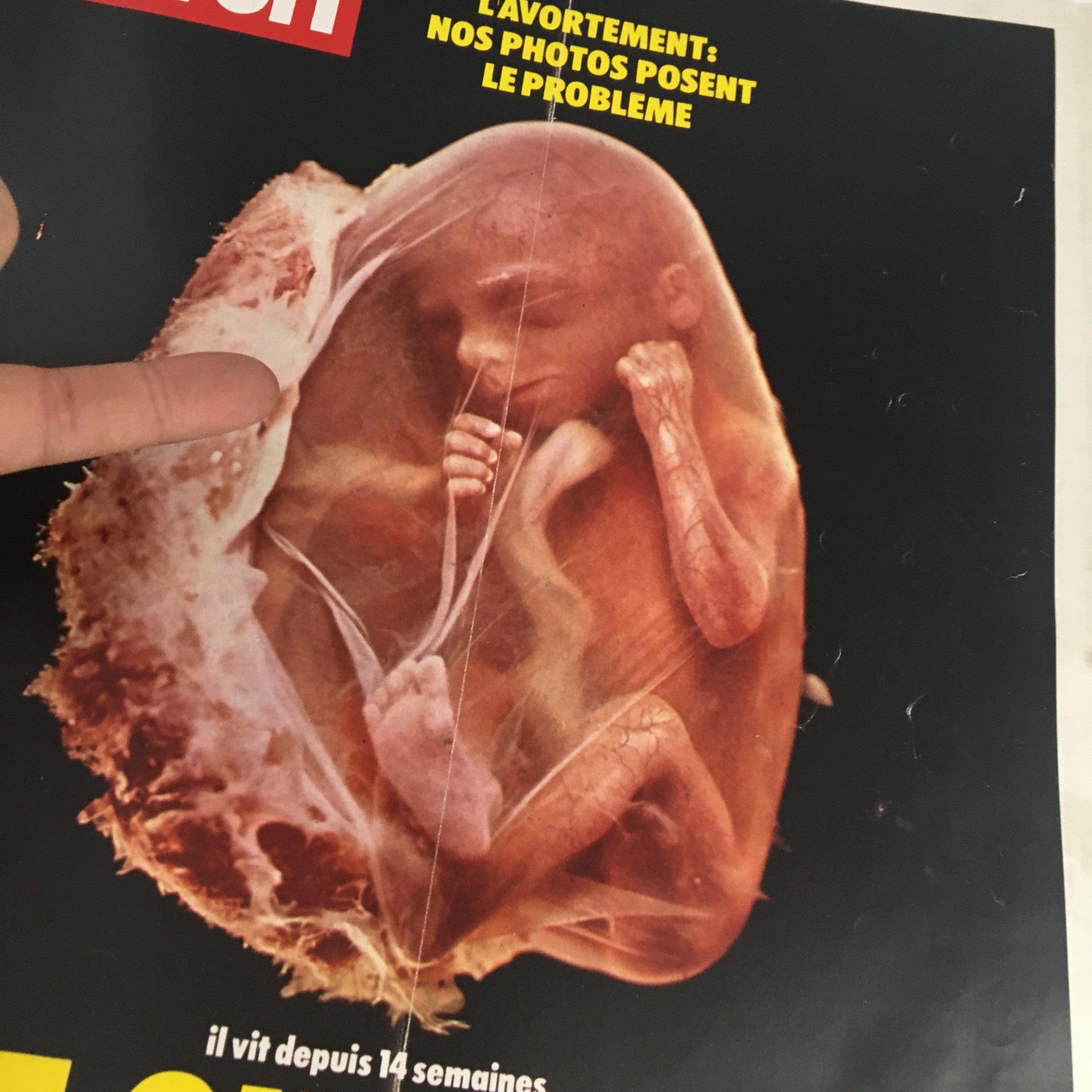 Close-up view of the Paris Match Magazine February 1973 cover, highlighting the fetus image and the title 'L'avortement: Nos Photos Posent Le Problema', raising ethical issues regarding abortion.