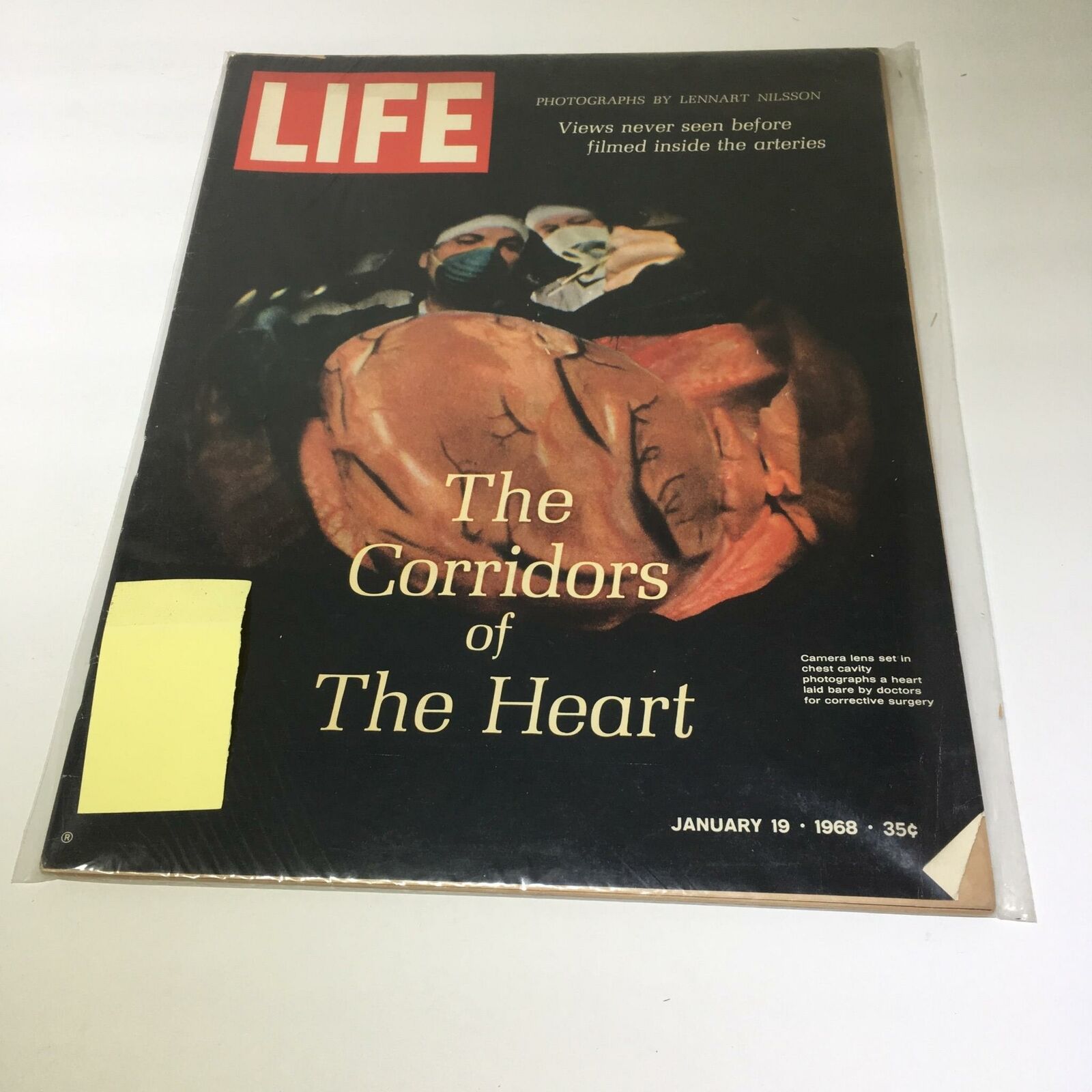 VTG Life Magazine January 19 1966 - The Corridors of Heart / Chest Activity