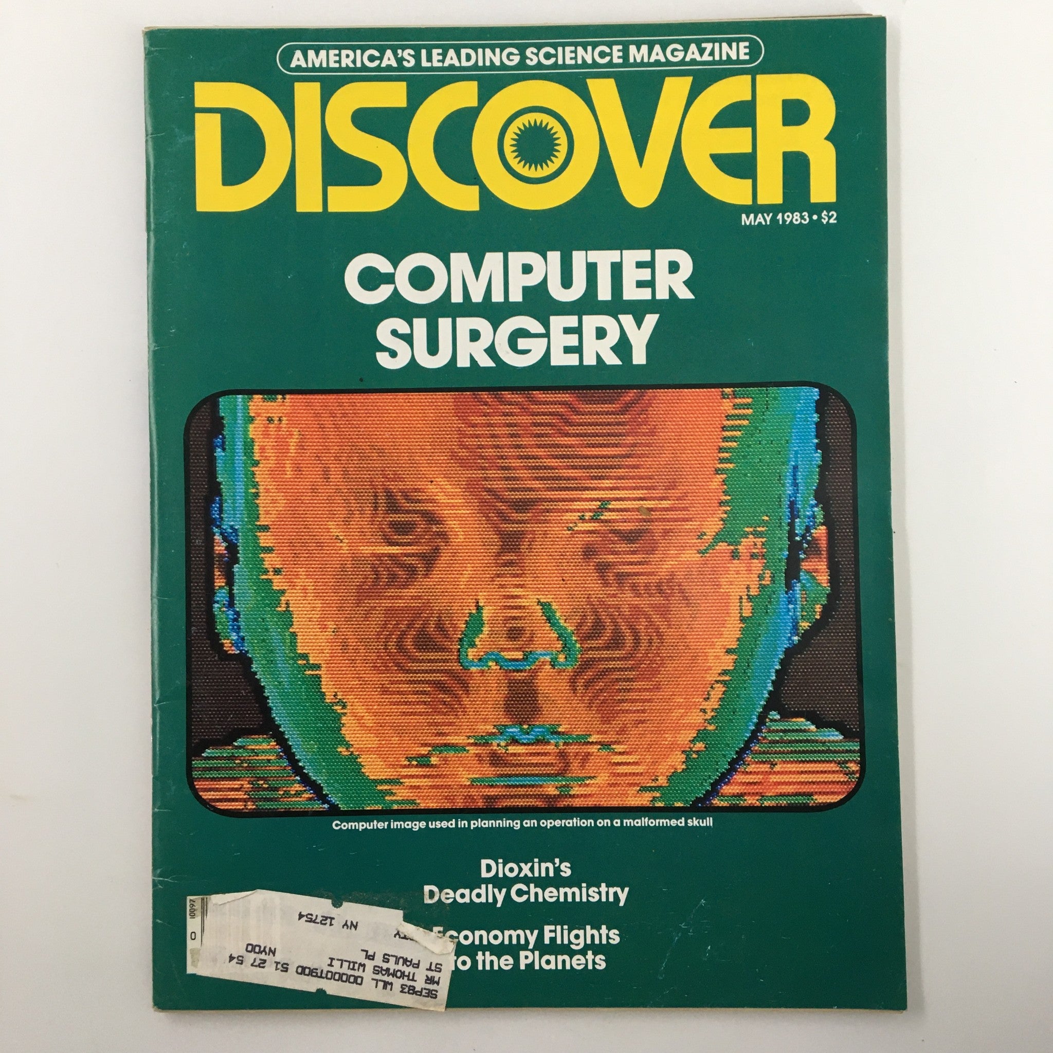 VTG Discover Magazine May 1983 cover featuring 'Computer Surgery' and 'Dioxin's Deadly Chemistry'. The cover displays a colorful computer-generated image of a human head, showcasing advancements in medical technology during the 1980s.