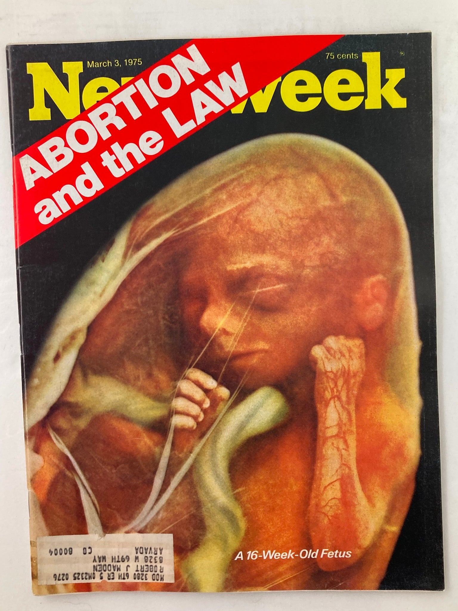 VTG Newsweek Magazine March 3 1975 Abortion and the Law